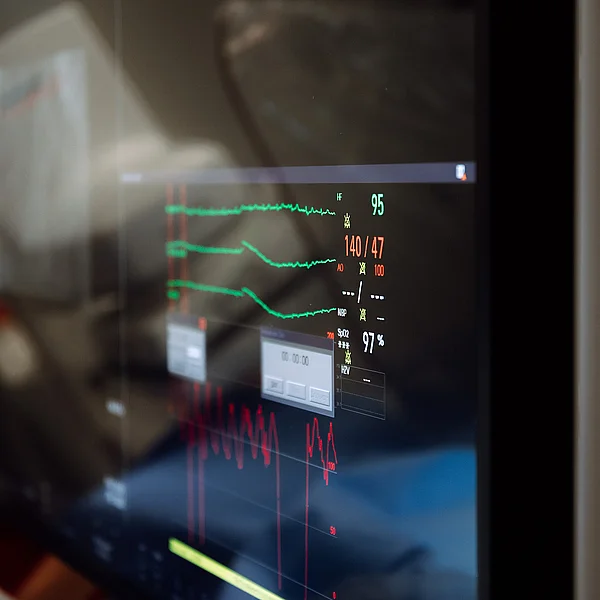 Monitor mit Vitalparametern und EKG-Kurven