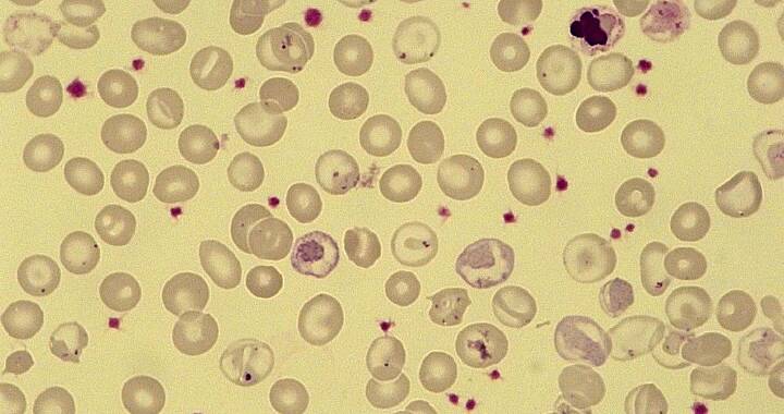 Helles Gelb mit Blutkörperchen auf der vereinzelt rote Punkte zu erkenneen sind, die auf eine Erkrankung hindeuten.