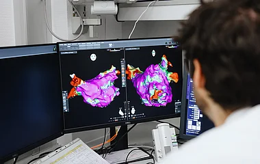 Ein Mitarbeiter analysiert farblich dargestellte medizinische Bildaufnahmen der Lunge an einem Computerarbeitsplatz. Mitarbeiter betrachtet medizinische Bildaufnahmen der Lunge am Monitor